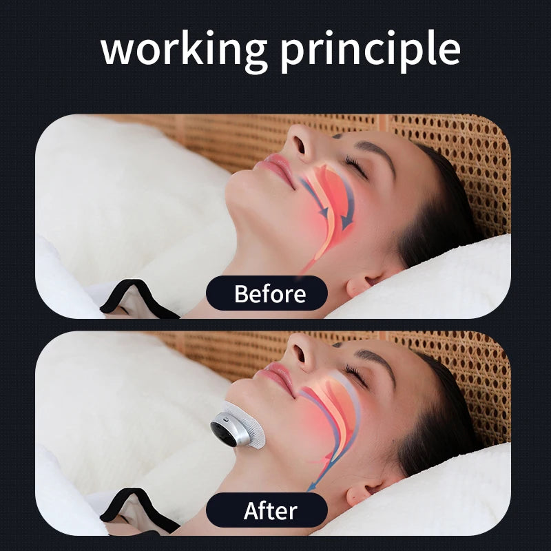 Anti-Snore Device with Dual-Pulse Stimulation